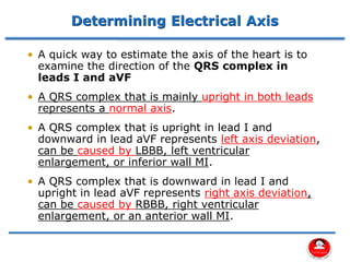 Comprehensive Assessment of Cardiovascular System Using 12 Lead ECG | PDF