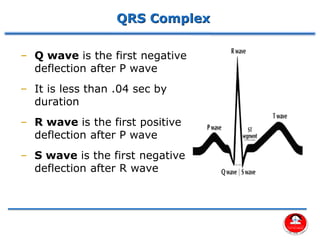 Qrs Complex Deflection Comprehensive Assessment of Cardiovascular System Using 12 Lead ECG | PDF