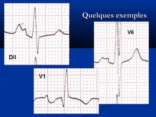 Quelques exemplesQuelques exemples
 