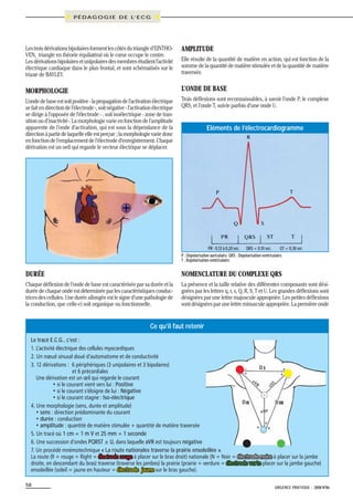 P É D A G O G I E D E L’ E C G

Les trois dérivations bipolaires forment les côtés du triangle d’EINTHOVEN, triangle en théorie équilatéral où le cœur occupe le centre.
Les dérivations bipolaires et unipolaires des membres étudient l’activité
électrique cardiaque dans le plan frontal, et sont schématisés sur le
triaxe de BAYLEY.

AMPLITUDE

MORPHOLOGIE

L’ONDE DE BASE

L’onde de base est soit positive - la propagation de l’activation électrique
se fait en direction de l’électrode -, soit négative - l’activation électrique
se dirige à l’opposée de l’électrode - , soit isoélectrique - zone de transition ou d’inactivité-. La morphologie varie en fonction de l’amplitude
apparente de l’onde d’activation, qui est sous la dépendance de la
direction à partir de laquelle elle est perçue ; la morphologie varie donc
en fonction de l’emplacement de l’électrode d’enregistrement. Chaque
dérivation est un oeil qui regarde le vecteur électrique se déplacer.

Trois déflexions sont reconnaissables, à savoir l’onde P, le complexe
QRS, et l’onde T, suivie parfois d’une onde U.

Elle résulte de la quantité de matière en action, qui est fonction de la
somme de la quantité de matière stimulée et de la quantité de matière
traversée.

Eléments de l’électrocardiogramme

PR : 0,12 à 0,20 sec. QRS < 0,10 sec.
QT < 0,38 sec
P : Dépolarisation auriculaire. QRS : Dépolarisation ventriculaire.
T : Repolarisation ventriculaire.

DURÉE

NOMENCLATURE DU COMPLEXE QRS

Chaque déflexion de l’onde de base est caractérisée par sa durée et la
durée de chaque onde est déterminée par les caractéristiques conductrices des cellules. Une durée allongée est le signe d’une pathologie de
la conduction, que celle-ci soit organique ou fonctionnelle.

La présence et la taille relative des différentes composants sont désignées par les lettres q, r, s, Q, R, S, T et U. Les grandes déflexions sont
désignées par une lettre majuscule appropriée. Les petites déflexions
sont désignées par une lettre minuscule appropriée. La première onde

Ce qu’il faut retenir
Le tracé E.C.G., c’est :
1. L’activité électrique des cellules myocardiques
2. Un nœud sinusal doué d’automatisme et de conductivité
3. 12 dérivations : 6 périphériques (3 unipolaires et 3 bipolaires)
D
et 6 précordiales
Une dérivation est un œil qui regarde le courant
• si le courant vient vers lui : Positive
• si le courant s’éloigne de lui : Négative
• si le courant stagne : Iso-électrique
D
D
4. Une morphologie (sens, durée et amplitude)
• sens : direction prédominante du courant
• durée : conduction
• amplitude : quantité de matière stimulée + quantité de matière traversée
5. Un tracé où 1 cm = 1 m V et 25 mm = 1 seconde
6. Une succession d’ondes PQRST ± U, dans laquelle aVR est toujours négative
7. Un procédé mnémotechnique « La route nationales traverse la prairie ensoleillée ».
La route (R = rouge = Right = électrode rouge à placer sur le bras droit) nationale (N = Noir = électrode noire à placer sur la jambe
droite, en descendant du bras) traverse (traverse les jambes) la prairie (prairie = verdure = électrode verte placer sur la jambe gauche)
ensoleillée (soleil = jaune en hauteur = électrode jaune sur le bras gauche).
58

URGENCE PRATIQUE - 2008 No86

 
