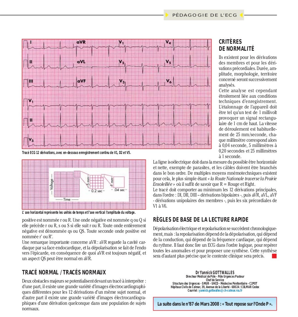 Ecg pour les nuls partie 1