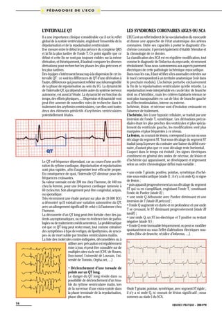 P É D A G O G I E D E L’ E C G

L’intervalle QT

Les syndromes coronaires aigus ou SCA

Il a une importance clinique considérable car il est le reflet
global de la systole ventriculaire, englobant l’ensemble de la
dépolarisation et de la repolarisation ventriculaire.
Il se mesure entre le début le plus précoce du complexe QRS
et la fin la plus tardive de l’onde T. Ce point signifie que ce
début et cette fin ne sont pas toujours visibles sur la même
dérivation, et théoriquement, il faudrait comparer les diverses
dérivations pour rechercher les phases les plus précoces et
les plus tardives.
Des équipes s’intéressent beaucoup à la dispersion de cet intervalle QT : ce sont les différences de QT d’une dérivation à
l’autre, différences qui pourraient refléter une inhomogénéïté
de la phase de repolarisation au sein du VG. La dynamicité
de l’intervalle QT, qui dépend entre autre du système nerveux
autonome, est aussi à l’étude. La dynamicité est fonction du
temps, des efforts physiques, … Dispersion et dynamicité vont
peut être amener de nouvelles voies de recherche dans le
traitement des arythmies ventriculaires, car elles sont toutes
deux des éléments prédictifs d’arythmies ventriculaires
potentiellement létales.

L’ECG est un reflet indirect de la vascularisation du myocarde
et donne une approche de l’état anatomique des artères
coronaires. Outre ses capacités à porter le diagnostic d’ischémie coronaire, il permet également d’établir l’étendue et
la chronologie de ce dernier.
La classification des SCA est en régulière modification, tout
comme le diagnostic de l’infarctus du myocarde, récemment
révolutionné. Nous nous cantonnerons aux aspects purement
électriques de cette pathologie ischémique myocardique.
Dans tous les cas, il faut vérifier si les anomalies relevées sur
le tracé correspondent à un territoire anatomique (voir dans
le prochain module). L’ischémie perturbe exclusivement
la fin de la repolarisation ventriculaire qu’elle retarde. La
repolarisation reste interprétable en cas de bloc de branche
droit ou d’hémibloc, mais les critères habituels retenus ne
sont plus transposables en cas de bloc de branche gauche
ou d’électrostimulation, interne ou externe.
Ischémie, lésion et nécrose sont d’évolution croissante en
l’absence de traitement.
L’ischémie, liée à une hypoxie cellulaire, se traduit par une
inversion de l’onde T, symétrique. Les dérivations précordiales étant les plus proches des ventricules et plus spécialement du ventricule gauche, les modifications sont plus
marquées et plus fréquentes à ce niveau.
La lésion, ou courant de lésion, correspond à un sus ou sous
décalage du segment ST. Tout sous décalage du segment ST
traduit jusqu’à preuve du contraire une baisse du débit coronaire, d’autant plus que ce sous décalage reste horizontal.
L’aspect dans le temps est évolutif ; les signes électriques
combinent en général des ondes de nécrose, de lésion et
d’ischémie qui apparaissent, se développent et régressent
selon un ordre chronologique défini mais variable :

Le QT est fréquence dépendant, car au cours d’une accélération du rythme cardiaque, dépolarisation et repolarisation
sont plus rapides, afin d’augmenter leur efficacité propre.
En conséquence de quoi, l’intervalle QT diminue pour des
fréquences croissantes.
Sa valeur normale est de 390 ms chez l’homme, de 440 ms
chez la femme, pour une fréquence cardiaque ramenée à
60 cycles/mn. Son allongement peut être congénital, acquis,
ou sporadique.
Très récemment une étude portant sur plus de 24 000 ECG
a démontré qu’il existait une variation saisonnière du QT,
avec un allongement significatif de celui-ci à l’automne chez
l’homme.
La découverte d’un QT long peut être fortuite chez des patients asymptomatiques, ou mise en évidence lors de pathologies ou de traitements médicamenteux. La problématique
est que ce QT long peut rester muet, tout comme entraîner
des symptômes à type de vertiges, de lipothymies, de syncopes ou de mort subite par troubles ventriculaires malins.
La liste des molécules contre-indiquées, déconseillées ou à
utiliser avec précaution est régulièrement
mise à jour, et peut être consultée sur de
multiples sites via le net (CHU de Rouen,
Doccismef, Université de Louvain, Université de Toronto, Orpha.net, …)
• Déclenchement d’une torsade de
pointe sur un QT long.
Le danger du QT long réside dans sa
possibilité de déclenchement d’un trouble du rythme ventriculaire malin, lors
de la survenue d’une extra-systole dans
la phase terminale de la repolarisation,
phase dite active.
56

• une onde T géante, positive, pointue, symétrique d’ischémie sous endocardique (stade I) ; il n’y a ni onde Q, ni signe
de lésion ;
• puis apparaît progressivement un sus décalage du segment
ST qui va en s’amplifiant, englobant l’onde T, constituant
l’onde de Pardee (stade II) ;
• une onde Q débutante avec Pardee diminuant et une
inversion de T (stade III précoce) ;
• l’onde Q augmente en durée et en profondeur et une onde
T se creusant, le ST diminuant progressivement (stade III
tardif) ;
• une onde Q, un ST iso-électrique et T positive ou restant
négative (stade IV) ;
• l’onde Q reste immuable fréquemment, ou peut se modifier
spontanément ou sous l’effet d’altérations électriques nouvelles (bloc de branche, récidive d’infarctus, …).

Onde T géante, pointue, symétrique, avec segment ST rigide ;
il n’y a ni onde Q, ni courant de lésion significatif ; nous
sommes au stade I du SCA.
URGENCE PRATIQUE - 2008 No90

 