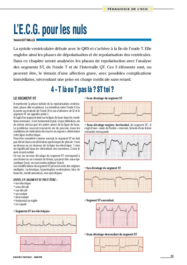 Ecg pour les nuls partie 4