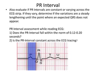 Pr Interval Ruler Ecg power point | PDF