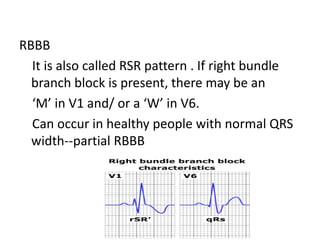Rsr Pattern Ecg Ecg power point | PDF