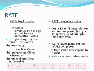 Two Consecutive R Waves Ecg ppp.pptx 2 | PPTX