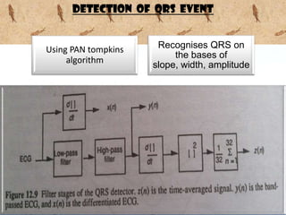 DETECTION OF QRS EVENT


Using PAN tompkins    Recognises QRS on
                          the bases of
     algorithm
                     slope, width, amplitude




                                               Page 12
 