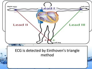 ECG is detected by Einthoven's triangle
               method

                                          Page 5
 