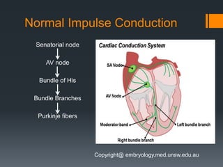 Normal Impulse Conduction
Senatorial node
AV node
Bundle of His
Bundle Branches
Purkinje fibers
Copyright@ embryology.med.unsw.edu.au
 