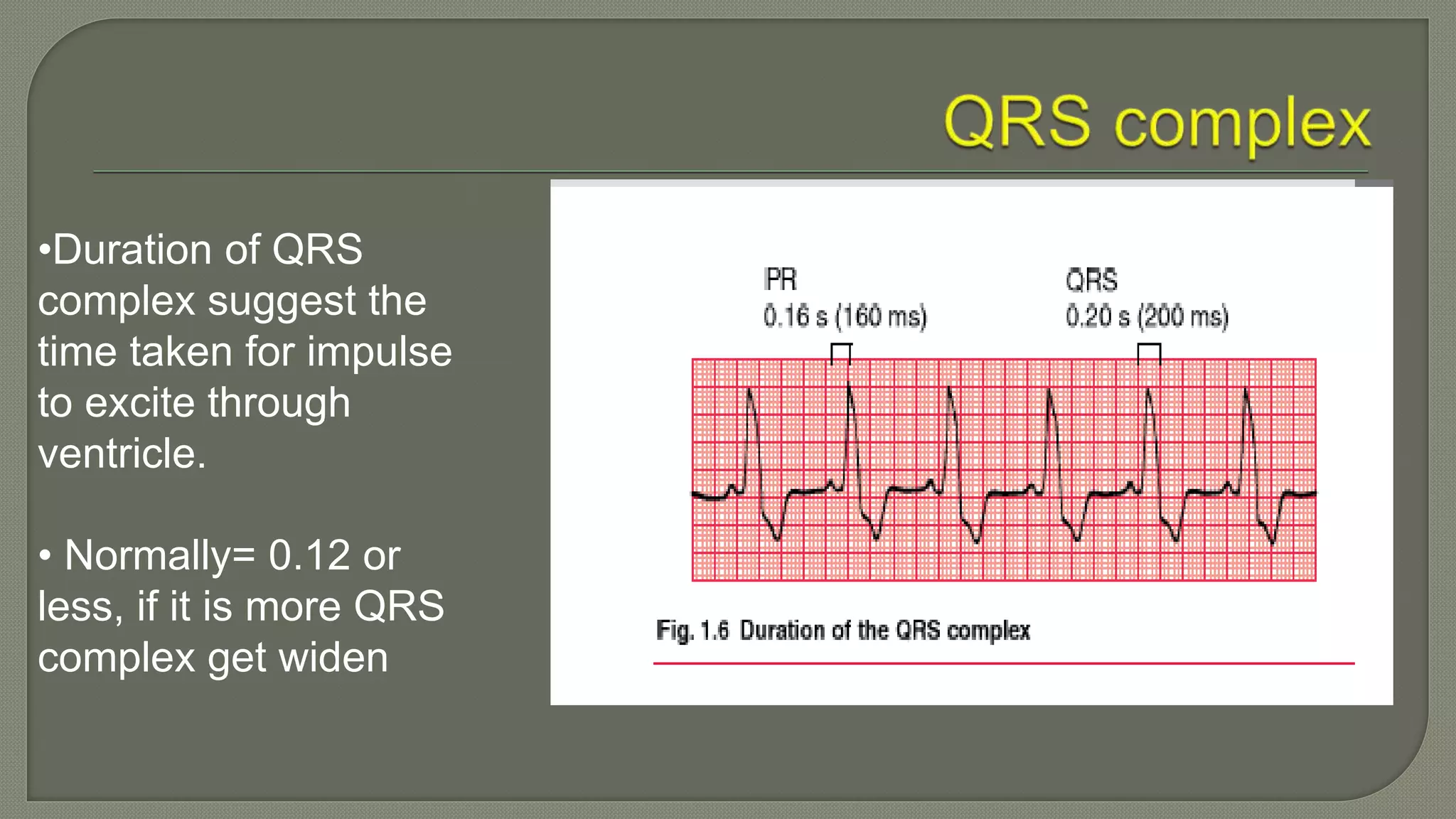 •Duration of QRS
complex suggest the
time taken for impulse
to excite through
ventricle.
• Normally= 0.12 or
less, if it is more QRS
complex get widen
 