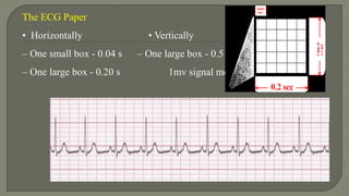The ECG Paper
• Horizontally • Vertically
– One small box - 0.04 s – One large box - 0.5 cm
– One large box - 0.20 s 1mv signal moves stylus by 1cm
 