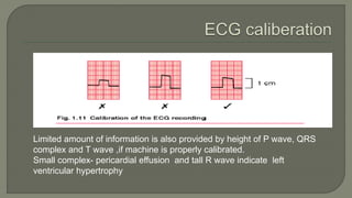 Limited amount of information is also provided by height of P wave, QRS
complex and T wave ,if machine is properly calibrated.
Small complex- pericardial effusion and tall R wave indicate left
ventricular hypertrophy
 