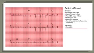 Ecg ppt