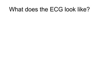 What does the ECG look like?
 