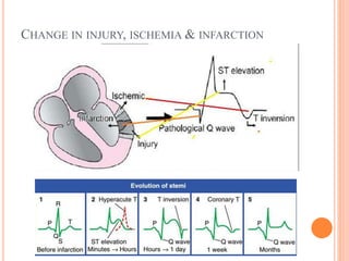 CHANGE IN INJURY, ISCHEMIA & INFARCTION
 