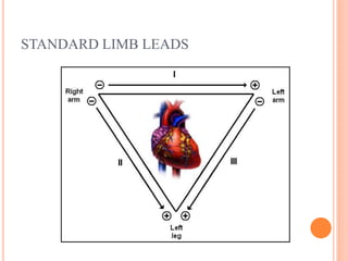 STANDARD LIMB LEADS
 