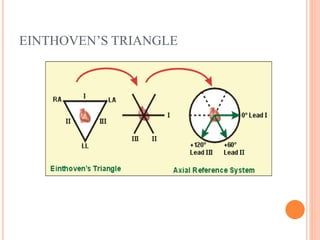 EINTHOVEN’S TRIANGLE
 