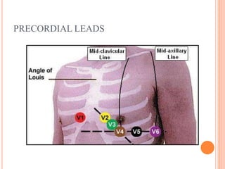 PRECORDIAL LEADS
 