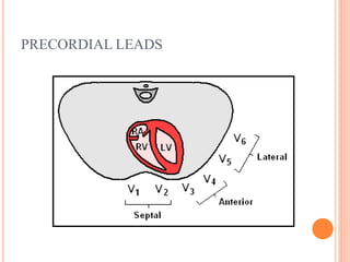 PRECORDIAL LEADS
 