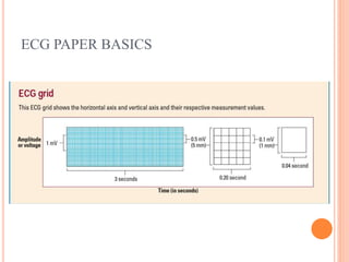 ECG PAPER BASICS
 