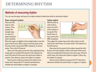 DETERMINING RHYTHM
 