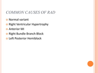 COMMON CAUSES OF RAD
 Normal variant
 Right Ventricular Hypertrophy
 Anterior MI
 Right Bundle Branch Block
 Left Posterior Hemiblock
 