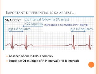 IMPORTANT DIFFERENTIAL IS SA ARREST…
 Absence of one P-QRS-T complex
 Pause is NOT multiple of P-P interval(or R-R interval)
 