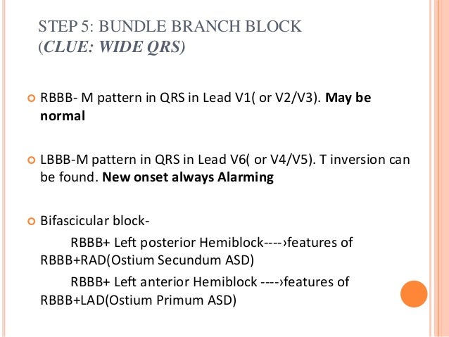 Basic of ECG and Easy Interpretation