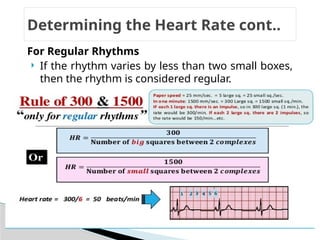 ECG ppt short.pptx powe point presentation on electrocardiography | PPTX