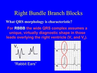 ECG Practicals.ppt for practical purpose | PPT