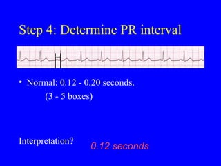 Pr Variable ECG Practicals.ppt for practical purpose | PPT