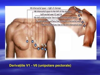 Derivaţiile V1 - V6 (unipolare pectorale)
 