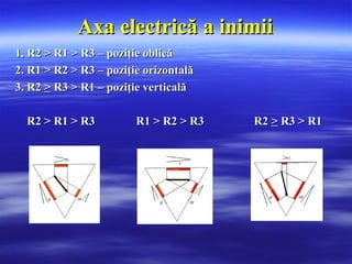 Axa electrică a inimiiAxa electrică a inimii
1. R2 > R1 > R3 – poziţie oblică1. R2 > R1 > R3 – poziţie oblică
2. R1 > R2 > R3 – poziţie orizontală2. R1 > R2 > R3 – poziţie orizontală
3. R23. R2 >> R3 > R1 – poziţie verticalăR3 > R1 – poziţie verticală
R2 > R1 > R3 R1 > R2 > R3 R2R2 > R1 > R3 R1 > R2 > R3 R2 >> R3 > R1R3 > R1
 