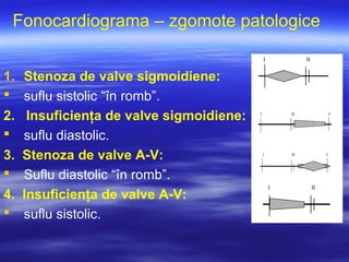 Fonocardiograma – zgomote patologice
1. Stenoza de valve sigmoidiene:
 suflu sistolic “în romb”.
2. Insuficienţa de valve sigmoidiene:
 suflu diastolic.
3. Stenoza de valve A-V:
 Suflu diastolic “în romb”.
4. Insuficienţa de valve A-V:
 suflu sistolic.
 