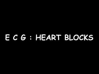 E C G : HEART BLOCKS   