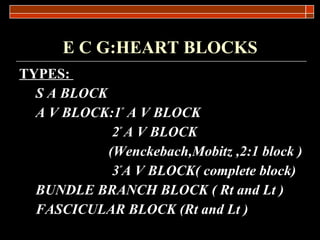 E C G:HEART BLOCKS TYPES:  S A BLOCK A V BLOCK:1 º  A V BLOCK 2 º  A V BLOCK (Wenckebach,Mobitz ,2:1 block ) 3 º A V BLOCK( complete block) BUNDLE BRANCH BLOCK ( Rt and Lt ) FASCICULAR BLOCK (Rt and Lt ) 