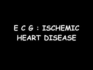 E C G : ISCHEMIC HEART DISEASE 