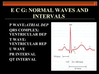 E C G: NORMAL WAVES AND INTERVALS   P WAVE: ATRIAL DEP QRS COMPLEX: VENTRICULAR DEP T WAVE: VENTRICULAR REP U WAVE PR INTERVAL QT INTERVAL 