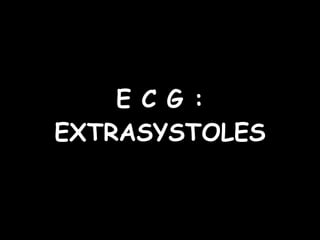 E C G : EXTRASYSTOLES 