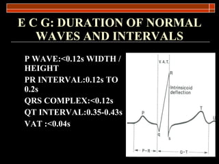 E C G: DURATION OF NORMAL WAVES AND INTERVALS P WAVE: < 0.12s WIDTH / HEIGHT PR INTERVAL: 0.12s TO 0.2s  QRS COMPLEX:<0.12s QT INTERVAL:0.35-0.43s VAT :<0.04s 
