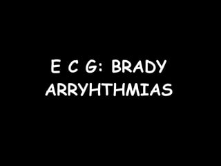 E C G: BRADY ARRYHTHMIAS 
