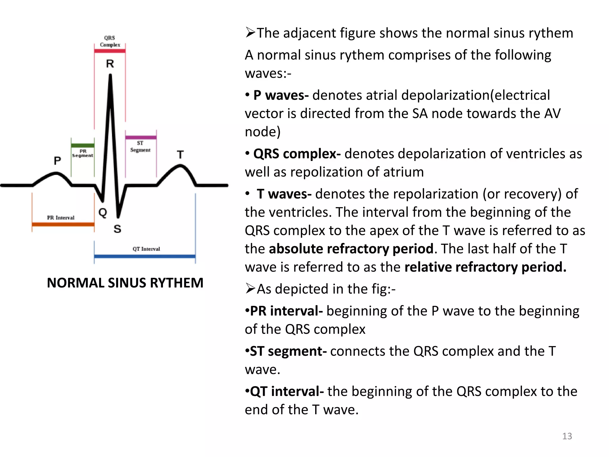 NORMAL SINUS RYTHEM
The adjacent figure shows the normal sinus rythem
A normal sinus rythem comprises of the following
waves:-
• P waves- denotes atrial depolarization(electrical
vector is directed from the SA node towards the AV
node)
• QRS complex- denotes depolarization of ventricles as
well as repolization of atrium
• T waves- denotes the repolarization (or recovery) of
the ventricles. The interval from the beginning of the
QRS complex to the apex of the T wave is referred to as
the absolute refractory period. The last half of the T
wave is referred to as the relative refractory period.
As depicted in the fig:-
•PR interval- beginning of the P wave to the beginning
of the QRS complex
•ST segment- connects the QRS complex and the T
wave.
•QT interval- the beginning of the QRS complex to the
end of the T wave.
13
 