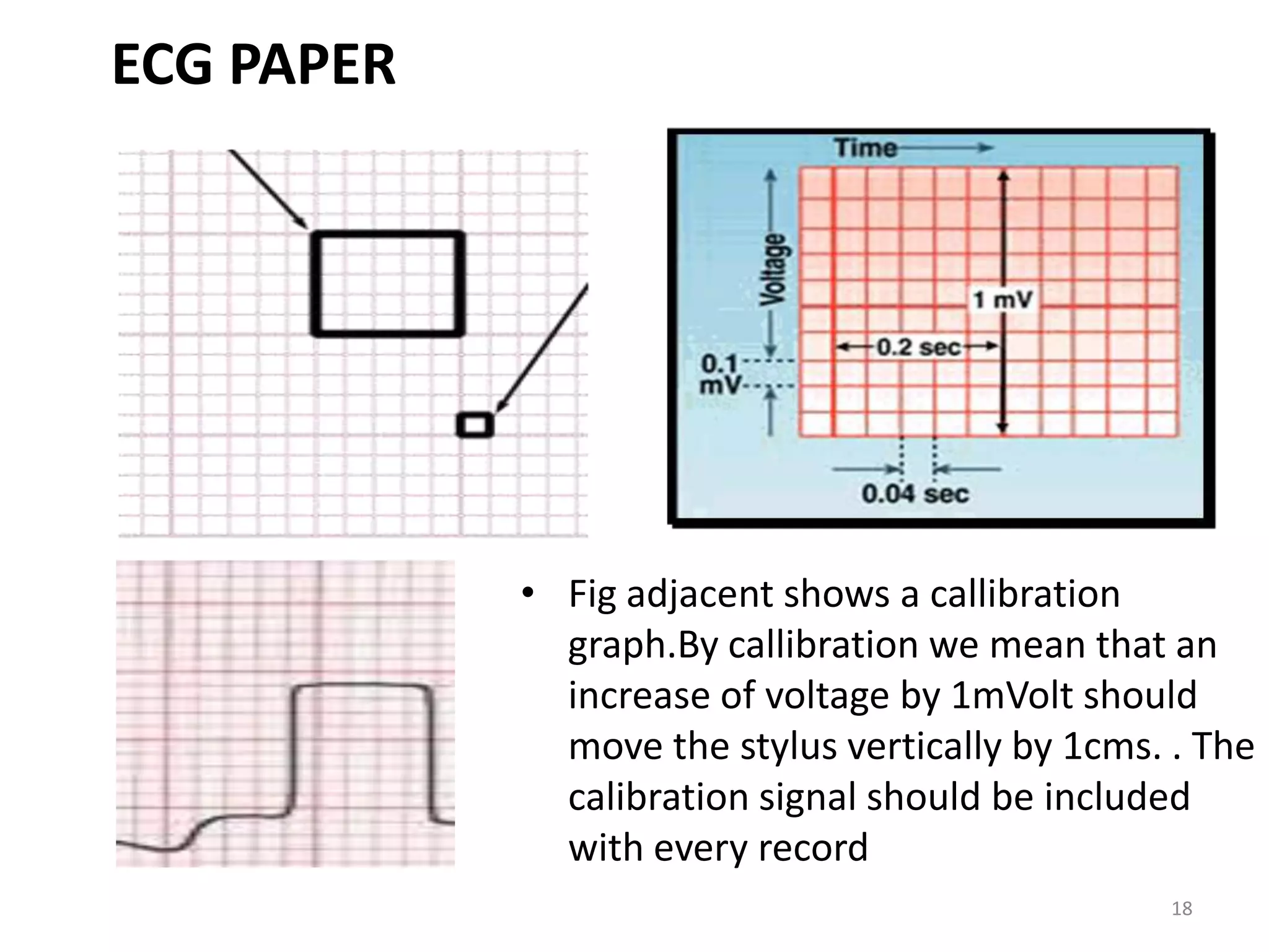 ECG PAPER
• Fig adjacent shows a callibration
graph.By callibration we mean that an
increase of voltage by 1mVolt should
move the stylus vertically by 1cms. . The
calibration signal should be included
with every record
18
 