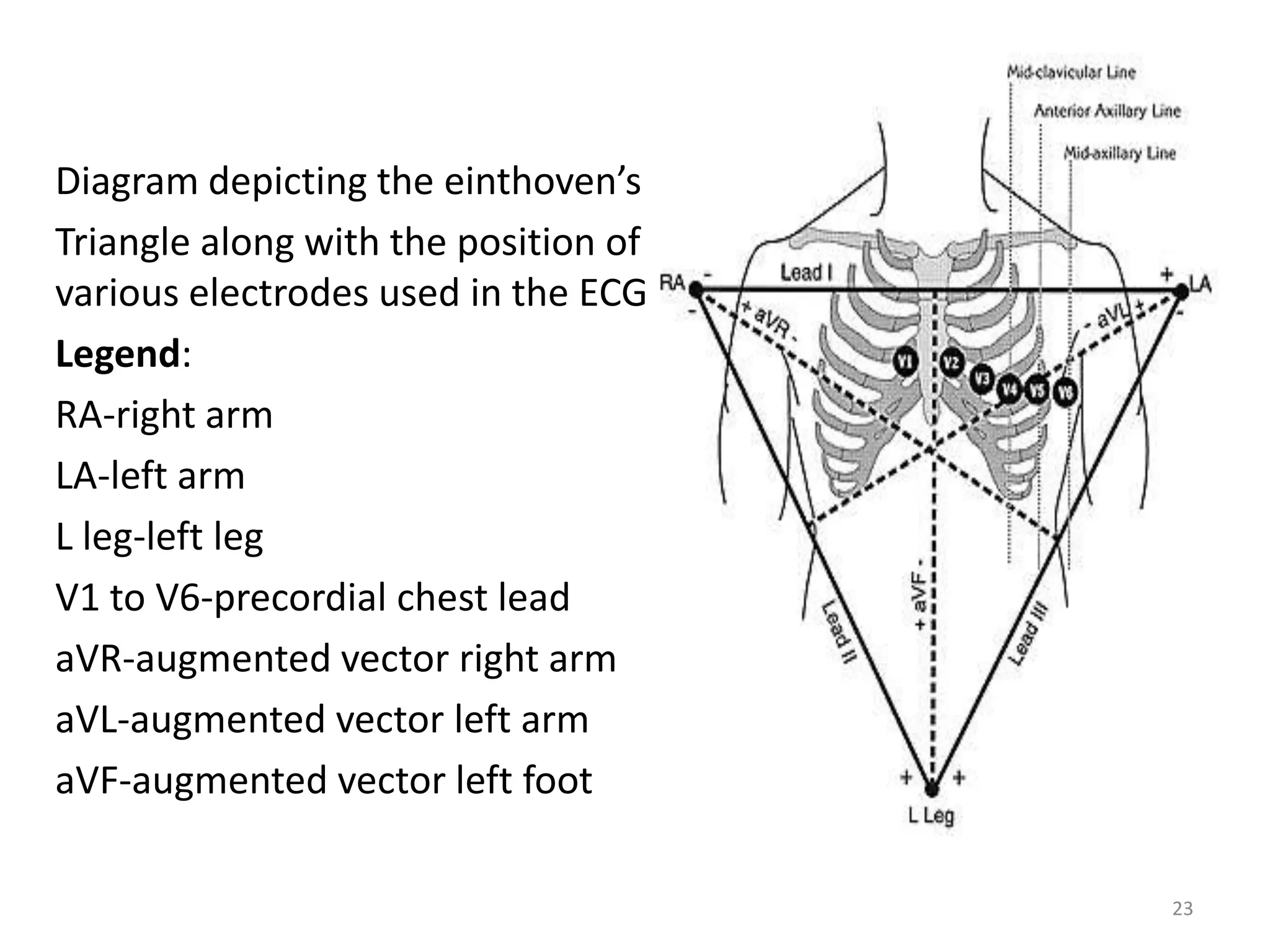 Diagram depicting the einthoven’s
Triangle along with the position of
various electrodes used in the ECG
Legend:
RA-right arm
LA-left arm
L leg-left leg
V1 to V6-precordial chest lead
aVR-augmented vector right arm
aVL-augmented vector left arm
aVF-augmented vector left foot
23
 