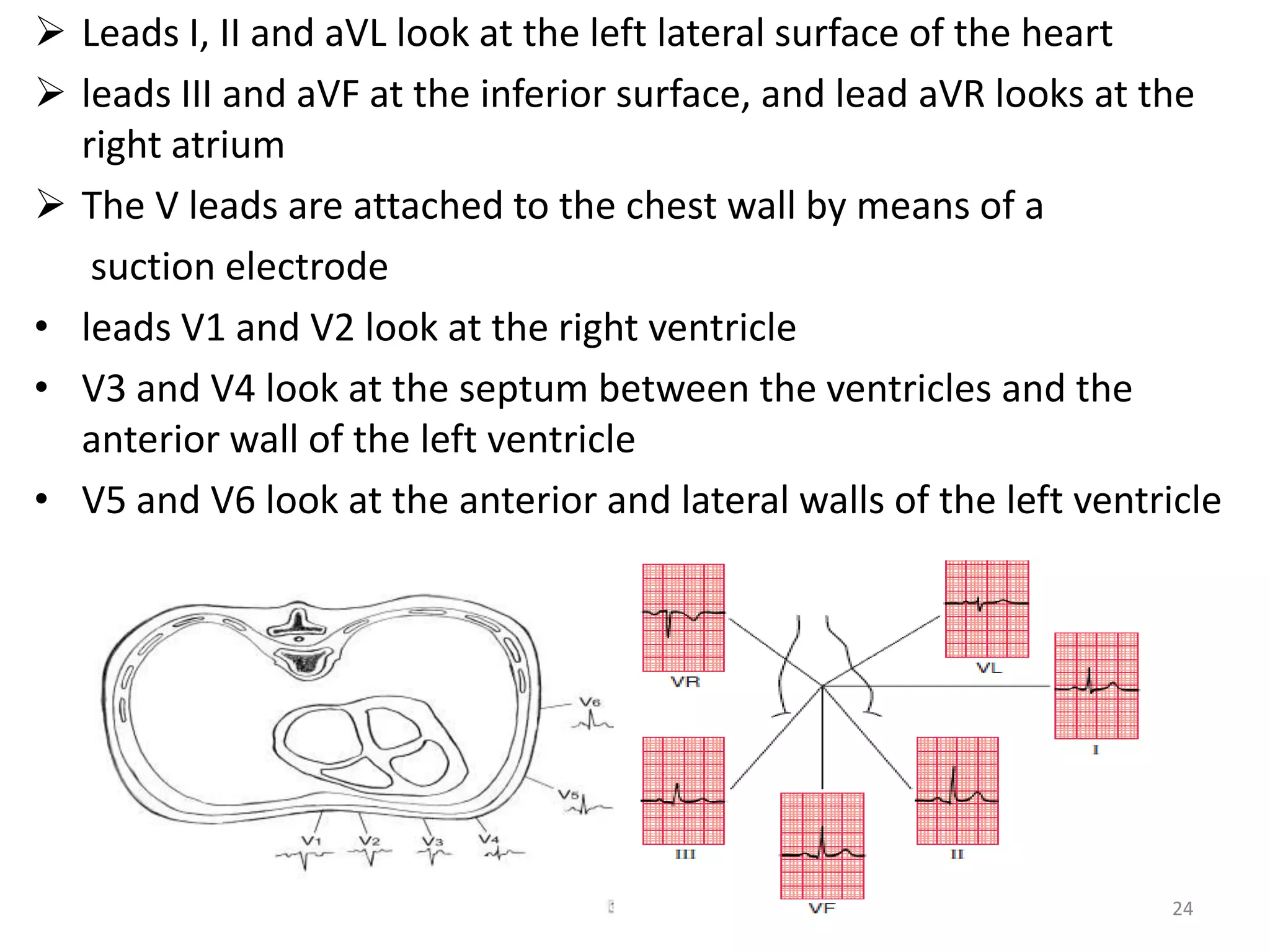 Leads I, II and aVL look at the left lateral surface of the heart
 leads III and aVF at the inferior surface, and lead aVR looks at the
right atrium
 The V leads are attached to the chest wall by means of a
suction electrode
• leads V1 and V2 look at the right ventricle
• V3 and V4 look at the septum between the ventricles and the
anterior wall of the left ventricle
• V5 and V6 look at the anterior and lateral walls of the left ventricle
24
 