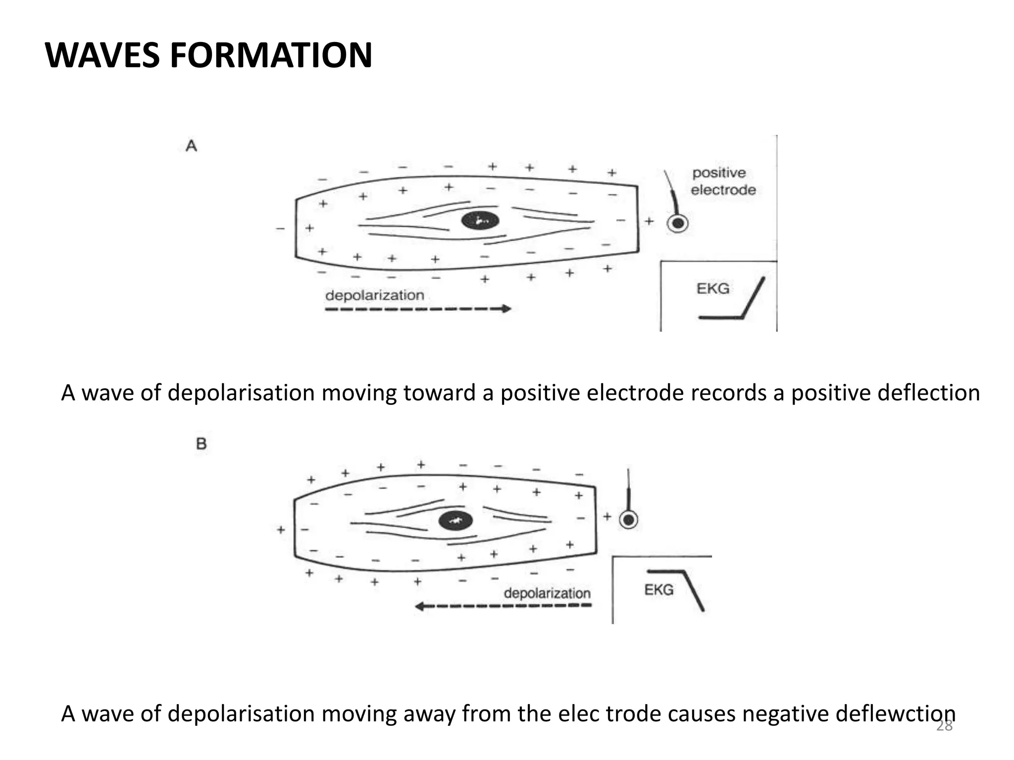 WAVES FORMATION
28
A wave of depolarisation moving toward a positive electrode records a positive deflection
A wave of depolarisation moving away from the elec trode causes negative deflewction
 