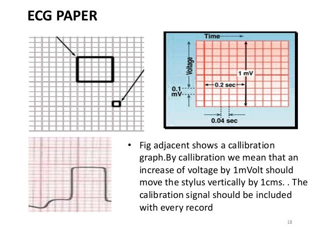 ecg graph paper measurements under fontanacountryinn com normal paper scale voltage calibration for ecg graph paper