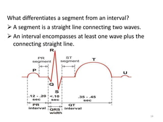 What differentiates a segment from an interval?
 A segment is a straight line connecting two waves.
 An interval encompasses at least one wave plus the
connecting straight line.
14
 