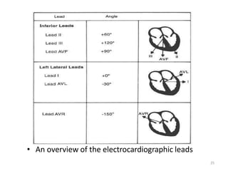 • An overview of the electrocardiographic leads
25
 