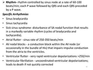 32
 Rhythm- rhythm controlled by sinus node at a rate of 60-100
beats/min; each P wave followed by QRS and each QRS preceded
by a P wave.
Specific Arrhythmias
• Sinus bradycardia
• Sinus tachycardia
• Sick sinus syndrome- disturbance of SA nodal function that results
in a markedly variable rhythm (cycles of bradycardia and
tachycardia).
• Atrial flutter - sinus rate of 250-350 beats/min
• AV nodal blocks - a conduction block within the AV node (or
occasionally in the bundle of His) that impairs impulse conduction
from the atria to the ventricles.
• Ventricular flutter - very rapid ventricular depolarizations >250/min
• Ventricular fibrillation - uncoordinated ventricular depolarizations;
leads to death if not quickly corrected
 